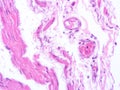 picture of histology human tissue with microscope from laboratory (not Illustration Designation)