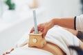 Picture of moxibustion therapy on woman body