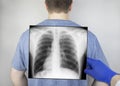 A chest x-ray of a man from the back. A doctor radiologist is studying an x-ray examination. A picture of the organs of the chest