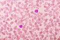 Picture of blood cell in blood smear