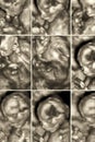 Pictures of 4D Ultrasound of baby in mother's womb. Collage of 3D Echography images