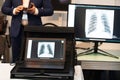 Pictures of human ribs on the monitor of a portable X-ray machine. Mobile medical equipment in action