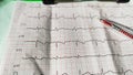 Piece of ECG paper, medical care for heart failure patients, showing normal sinus rhythm. Royalty Free Stock Photo