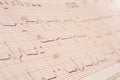 piece of a electrocardiogram close up. selective focus, tinted image