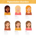 Pigmentation disorders. Isolated art