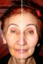 Pigmentation on the face. Brown spots and wrinkles on the skin of the face. Nasolabial folds. One half of the face is