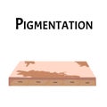 Pigmentation on the skin. A pigmented spot on the skin of the face. Vector illustration