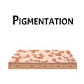 Pigmentation on the skin. A pigmented spot on the skin of the face. Vector illustration