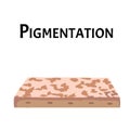 Pigmentation on the skin. A pigmented spot on the skin of the face. Vector illustration