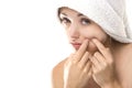 Pimple , spot on beauty woman face Royalty Free Stock Photo