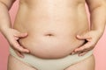 Pinch woman sagging belly closeup, folds on stomach, loose skin and cellulite, obesity. Naked overweight plus size girl