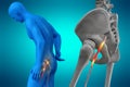 Pinched human sciatic nerve, anatomical vision. 3d illustration Royalty Free Stock Photo