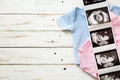 Pink and blue baby romper and ultrasound on white wood