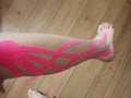 lymfatic tape on a leg after operation Royalty Free Stock Photo