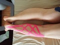 lymfatic tape on a leg after operation Royalty Free Stock Photo