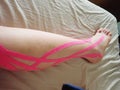 lymfatic tape on a leg after operation Royalty Free Stock Photo