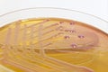 Pink and yellow bacterial culture on agar - sideview