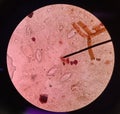 Pinworm eggs (Enterobius vermicularis)