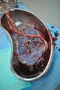 Placenta