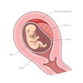 Placental abruption structure medical science Royalty Free Stock Photo