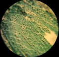 Plant cells under a microscope