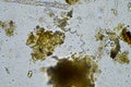 plant cellulose in a soil sample under the microscope Royalty Free Stock Photo