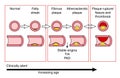 Plaque formation in artery