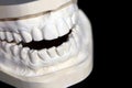 Plaster cast from above and lower teeth of human Royalty Free Stock Photo