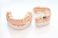 Plaster Cast of jaws. Dental casting gypsum model human Jaws in prosthetic laboratory. Dentistry, Orthodontics. Close up