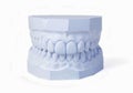 Plaster cast of set of teeth