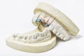 Plaster cast of teeth on white