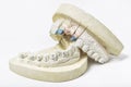 Plaster cast of teeth on white Royalty Free Stock Photo