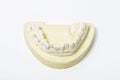 Plaster cast of teeth on white Royalty Free Stock Photo