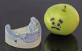 Plaster model of lower teeth with metal prosthesis next to crying green apple Royalty Free Stock Photo