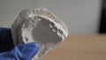 The plaster model of the maxilla in the hands of an orthodontist. orthodontist doctor in blue gloves indicates a problem