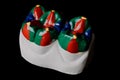 Plaster model of two molar teeth, painted