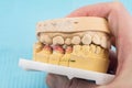 Plaster models of the jaws in the hands of a dental technician in a dental laboratory Royalty Free Stock Photo