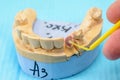 Plaster models of the jaws in the hands of a dental technician in a dental laboratory Royalty Free Stock Photo