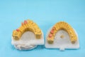 plaster models of the jaws in the hands of a dental technician in a dental laboratory Royalty Free Stock Photo