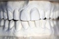 Plaster print of the human teeth Royalty Free Stock Photo