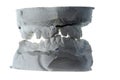 Plaster teeth cast Royalty Free Stock Photo