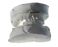 Plaster teeth cast Royalty Free Stock Photo