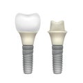 Plastic assembled tooth implant