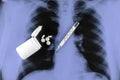 a plastic container with scattered pills and a thermometer on the background of an X-ray of the lungs Royalty Free Stock Photo