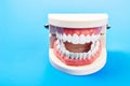 Plastic dental teeth model. Royalty Free Stock Photo