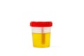 A plastic jar with an urine analysis isolated