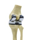 Plastic model of a knee replacement Royalty Free Stock Photo