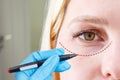 Plastic surgeon drawing dashed line under eye of girl. Hand in blue glove holding pencil. Plastic surgery, beauty