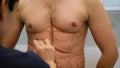 A plastic surgeon draws a markup for the operation of liposuction and liposculpture. A patient is a man, a man`s beauty