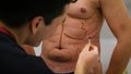A plastic surgeon draws a markup for the operation of liposuction and liposculpture. A patient is a man, a man`s beauty